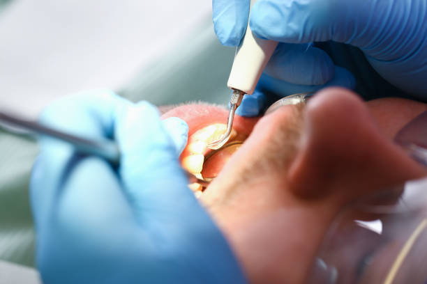 Best Dentist for Dental Trauma  in Sto Brook, NY